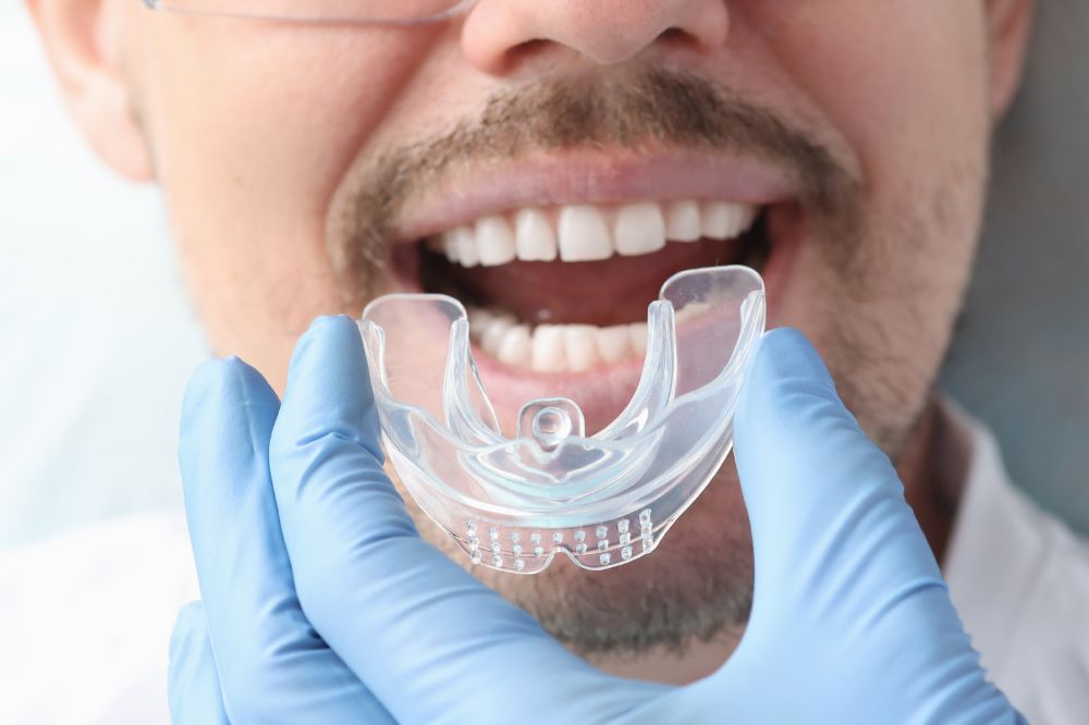 Mouthguards